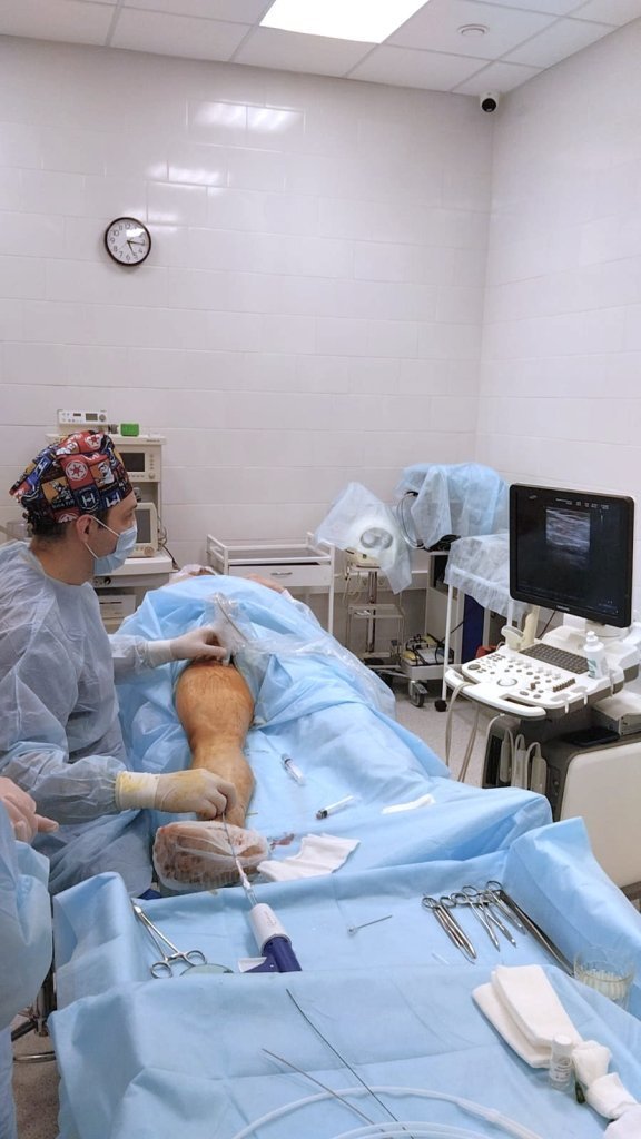 Клеевая облитерация Подольск